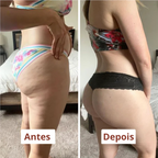 Drena Roller | Massageador linfático para lipedema e celulite